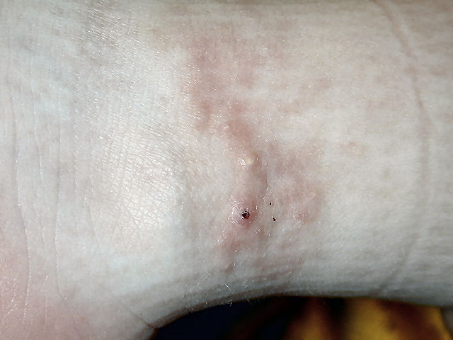 Tristan Project-Initial Pathology Report