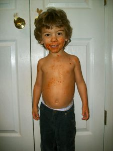 Tristan Project-Growth Hormone Testing