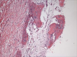 Tristan Project-Initial Pathology Report